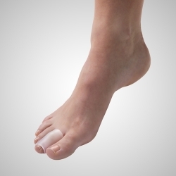 Separador interdigital en...